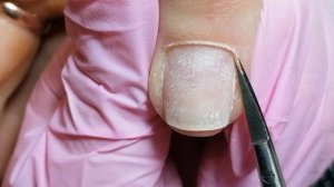 срез кутикулы твизерами