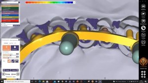 Моделировка первичной балки и каркаса в Exocad