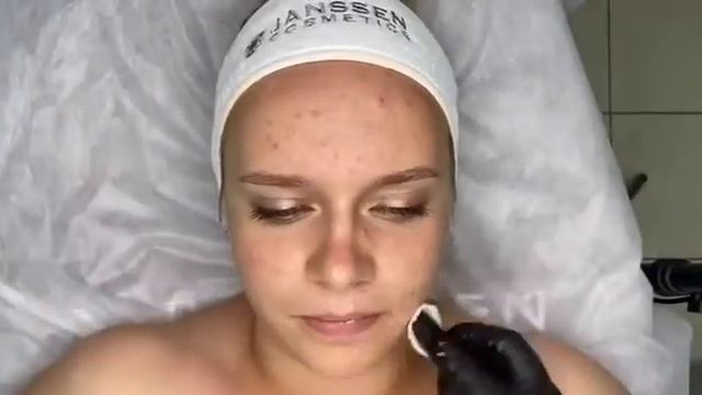 Уход для молодой кожи от Janssen Cosmetics в салоне косметолога. смотреть онлайн