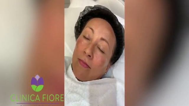 Clinica Fiore Skin Clinic London MELINE Peel смотреть онлайн