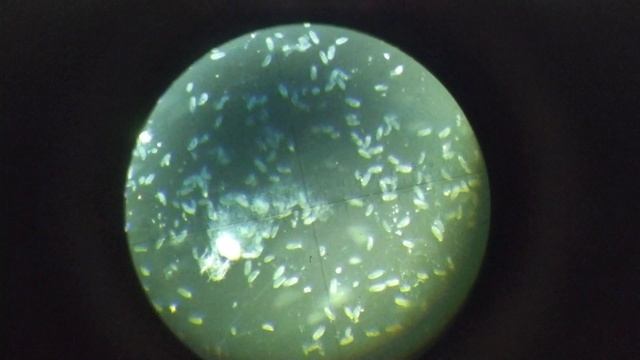 Инфузория туфелька стартовый корм для личинки сомика смотреть онлайн