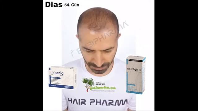Xpecia Tablet y Hairforte funcionan! смотреть онлайн