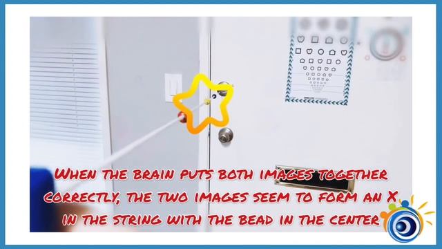 19. Brock String Vision Therapy To Train Anti-Suppression, Physiological Diplopia, & Eye-Teaming #1