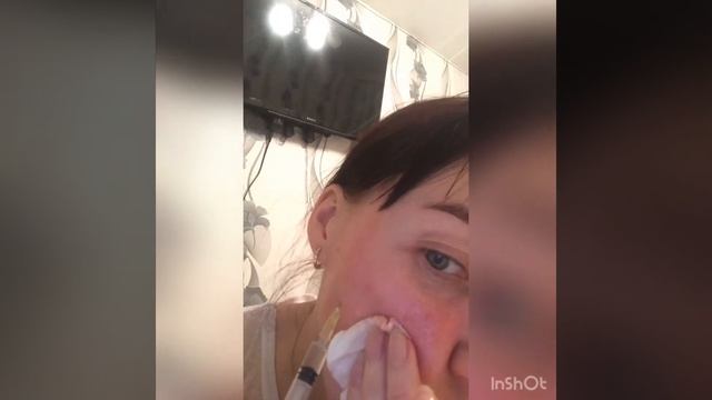 Мезотерапия в домашних условиях препаратом Veluderm Facelift 20(уколы красоты, биоревитализация) смотреть онлайн