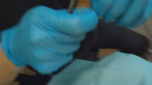 Циркониевая коронка на имплант 4.6 Обучающее видео для вр.интернов. 2ч. 4-я стоматология. 24.10.202