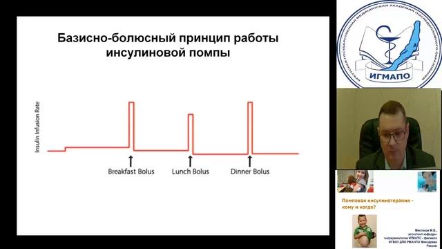 Помповая инсулинотерапия - кому и когда Мистяков МВ