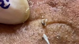 Enjoy Every Day With The Best Video Loan Nguyen Spa Official |  1411