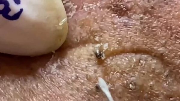 Enjoy Every Day With The Best Video Loan Nguyen Spa Official | 1411