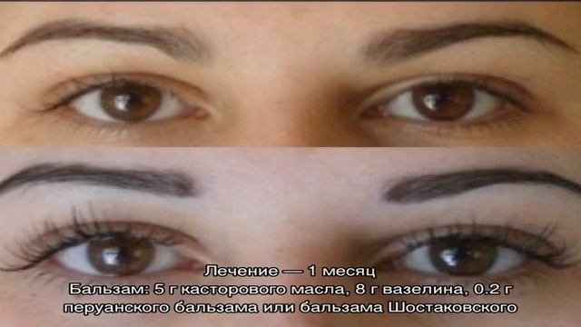 Как отрастить ресницы? Густые и длинные ресницы в домашних условиях. Как ухаживать за ресницами смотреть онлайн