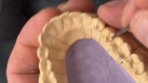 Восковое моделирование зубов