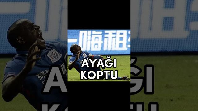 Maçta Ağır Sakatlık Geçiren Futbolcular #football #futbol #messi #ronaldo #benzema #vinicius #keşfe смотреть онлайн
