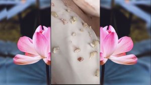 Выдавливание чёрных точек НОВОЕ! Удаление чёрных точек за ухом. p6