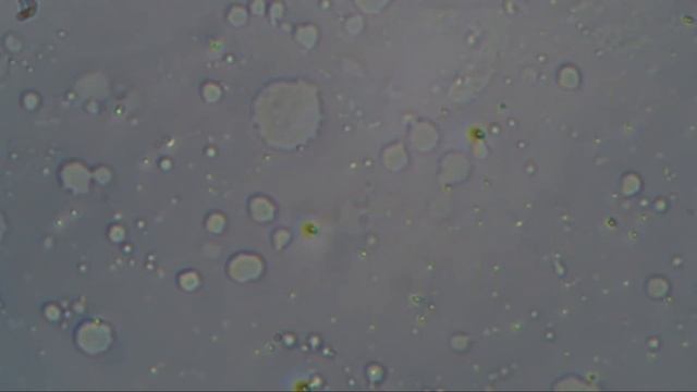 Развитие личинки Веревочного Червя, ( Масочный червь ) Seilwurm + Bacardi