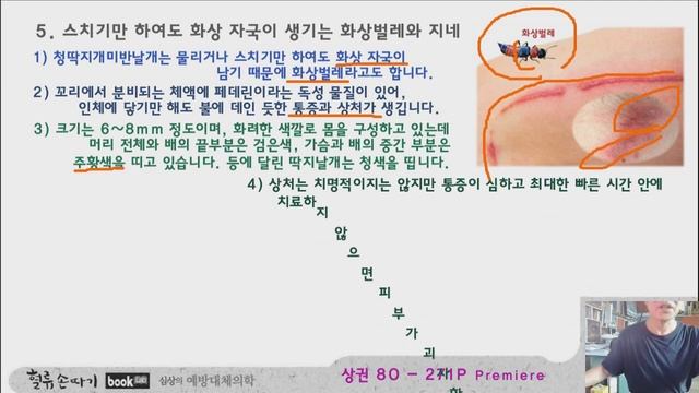 벌레병 93강. 벌레에게 물려 염증으로 죽어가는 사람들. people who die from insect bites. смотреть онлайн