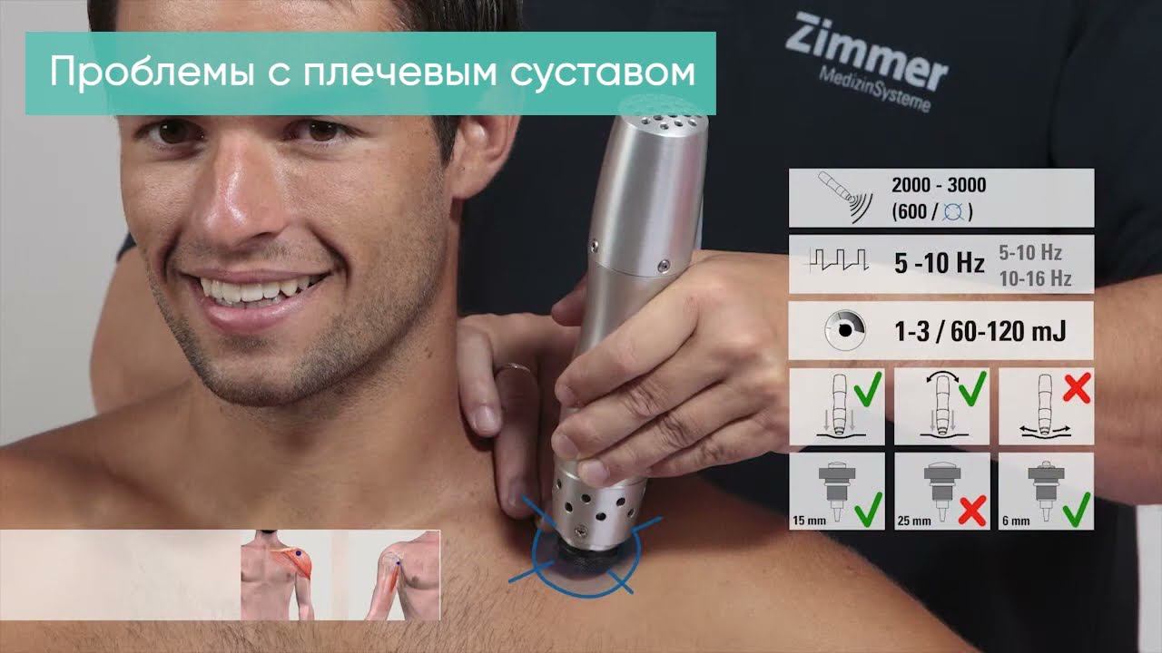 Обзор методик по применению аппарата УВТ EnPuls при различных патологиях смотреть онлайн