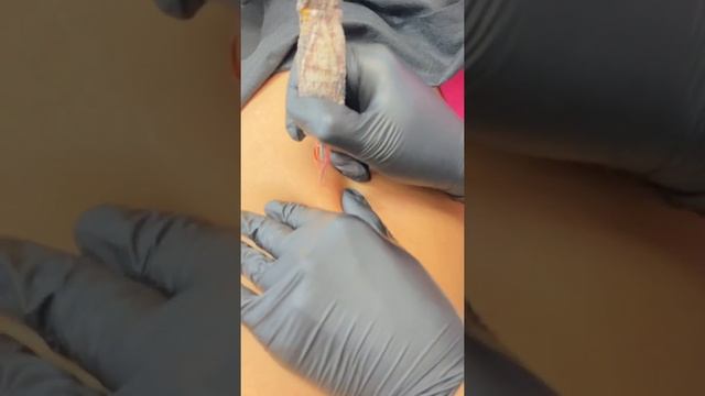 Растяжки на ногах смотреть онлайн