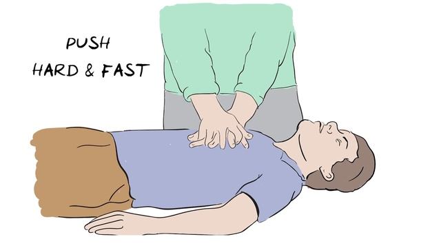 CPR - Simple Steps To Save A Life - Animated Explanation Video - Health Sketch