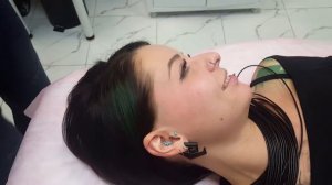 Как сделать микродермал (Арсений Андерссон)