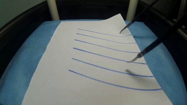 Эндоскопическая хирургия ЯГМУ. Занятие 2. Упражнение 1. "ВЫРЕЗАНИЕ ПО РАЗНОНАПРАВЛЕННЫМ ЛИНИЯМ" смотреть онлайн