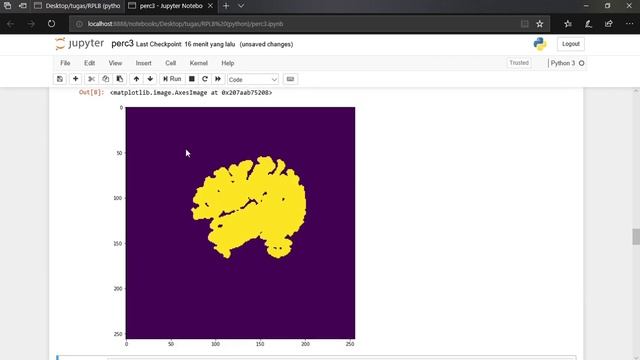 Brain Segmentation using Skull Stripping_Kmeans & Contour Method смотреть онлайн