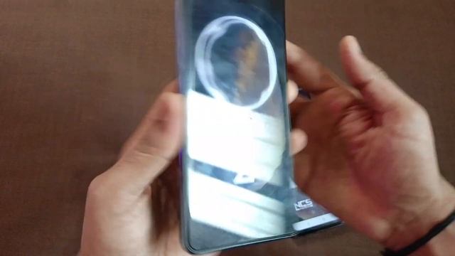 infinix GT 10 Pro Vs Infinix Note 30 5G Sound Test ( Useful ) смотреть онлайн