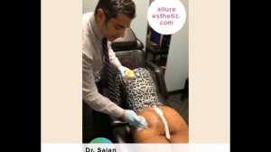 Non-Surgical Brazilian Butt Lift with Filler