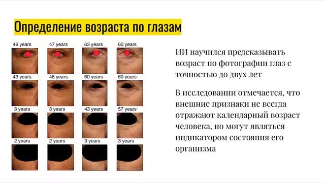 Искусственный интеллект в медицине и биологии смотреть онлайн