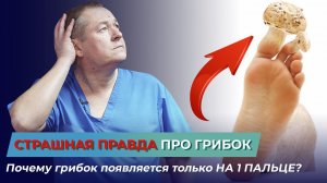 Страшная правда про ГРИБОК. Почему грибок появляется только на 1 пальце? Грибок на ногтях.