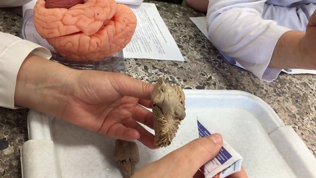 ‪Продолговатый мозг 1 смотреть онлайн