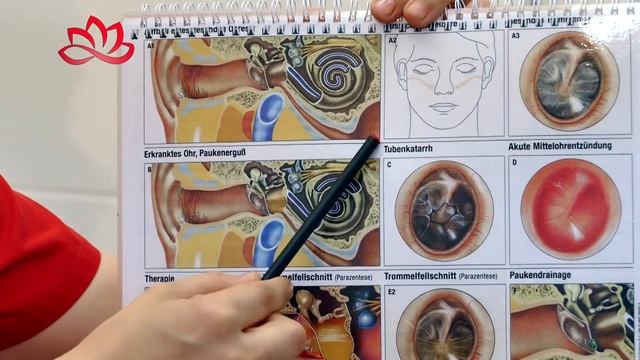 Отит смотреть онлайн