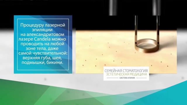 Лазерная эпиляция - рассказываю все о процедуре смотреть онлайн