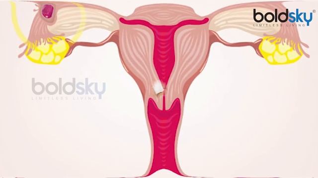 Period Date Change After Marriage | शादी के बाद पीरियड्स डेट बदलने की ये है वजह | Boldsky смотреть онлайн