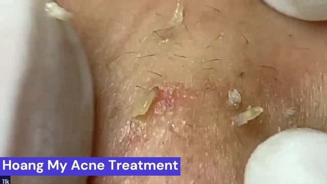 New POPPING videos 2023 смотреть онлайн