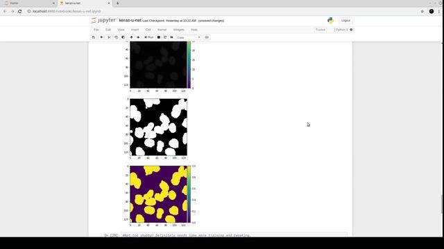 Convolutional Networks for Biomedical Image Segmentation (U-Net) pt-2 смотреть онлайн