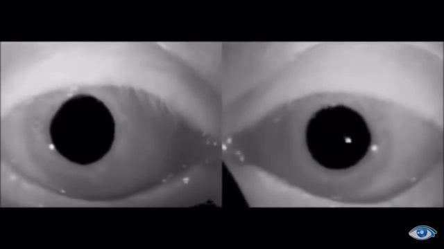 нистагм пример