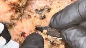 Amos' heavily jiggered left foot 1 of 2