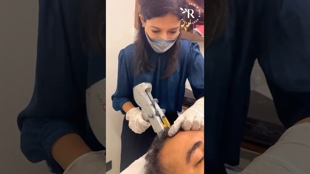 Hair PRP (Platelet-Rich Plasma) | Scalp Hair Restoration | Hair Loss Treatment | RasaDerm, New Delh смотреть онлайн