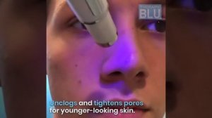 ? лазерная ручка для удаления вен, шрамов, акне?