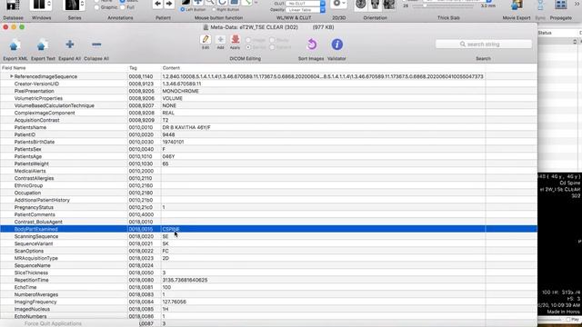 DICOM DATA - Technical note by Dr Velicheti Sandeep смотреть онлайн