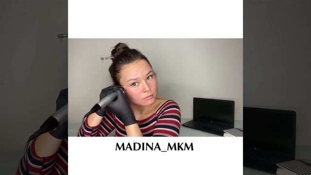 Что такое DermaPen