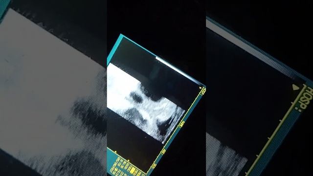 проверка коровы на стельность. демонстрация. клон AcuVista VT98b. от Санбрайт. Sunbright K-S100