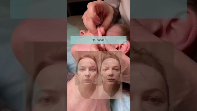 Массаж для лица от морщин — это набор техник, с помощью которых прорабатывается каждый участок лица смотреть онлайн