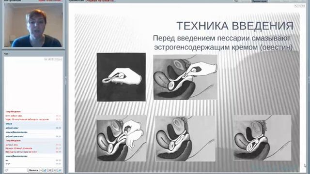 Вебинар ПРОСТОЕ РЕШЕНИЕ ДЕЛИКАТНЫХ ПРОБЛЕМ ПЕССАРИИ доктора АРАБИН др Черная НЕ 11 12 13 смотреть онлайн