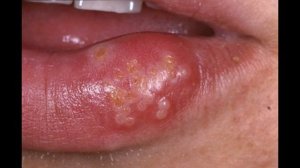 Что будет, если выпить уксус