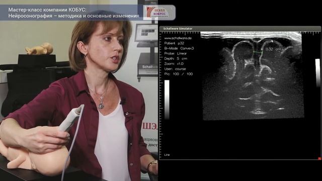Нейросонография — методика и основные исследования. Мастер-класс Компании Кобусс.