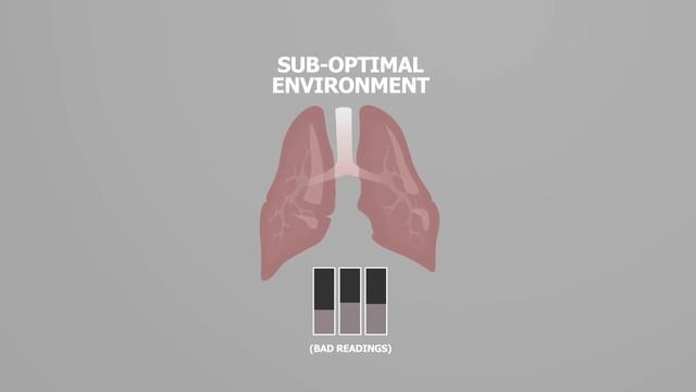 Organ Care System (OCS™) Lung смотреть онлайн