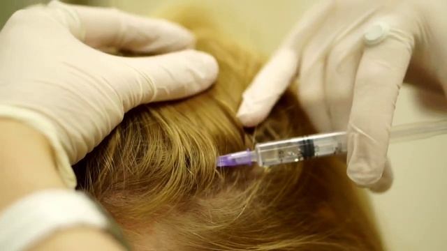 Мезотерапия смотреть онлайн