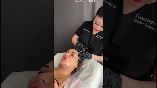 Идеальная кожа как после фотошопа #косметология #инъекции #ботокс #гиалуроновая_кислота смотреть онлайн