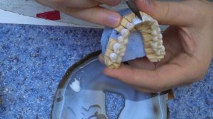 Нанесение керамики EMAX? На циркониевый каркас. Краски MIYO.  Изготовление зуба из керамики.