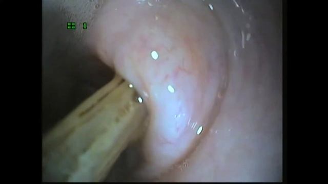 кость в желудке смотреть онлайн